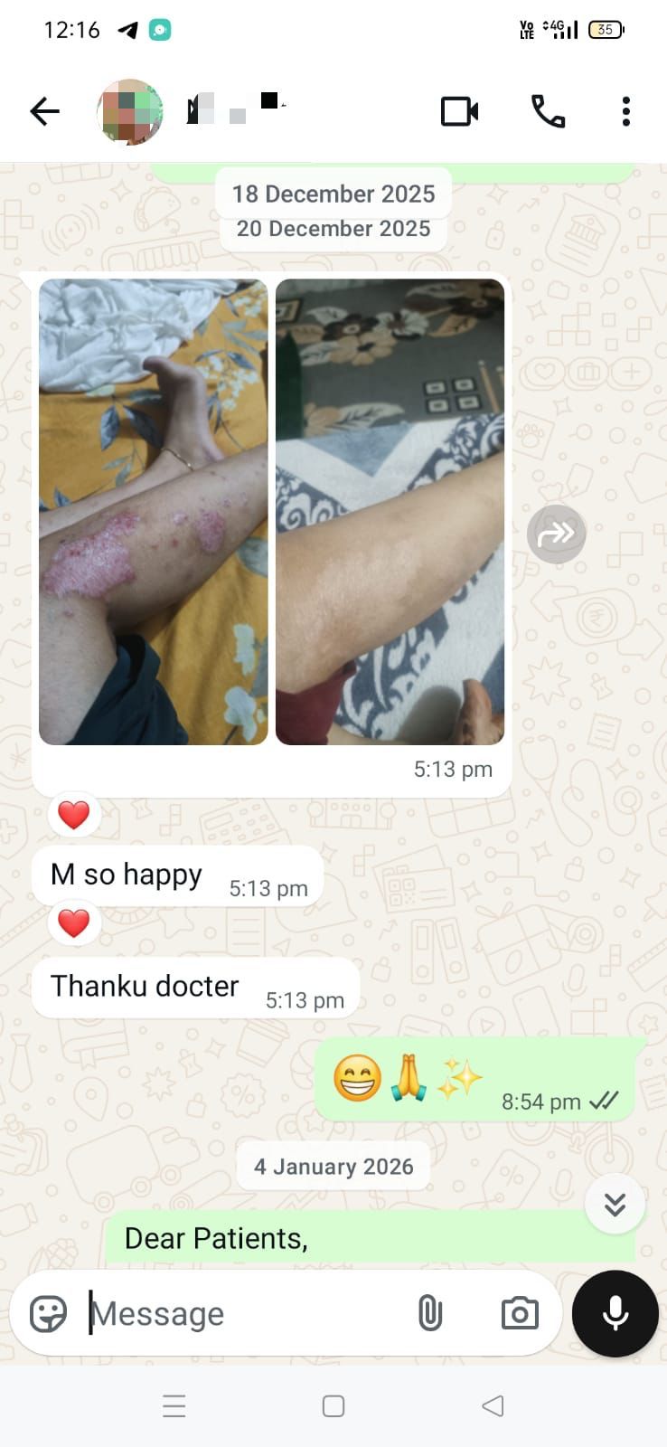 Treatment Success